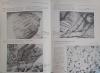 KODA, The world through the Electron Microscope. Metallurgy.